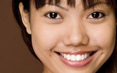 Teeth Whitening at Premier Dental