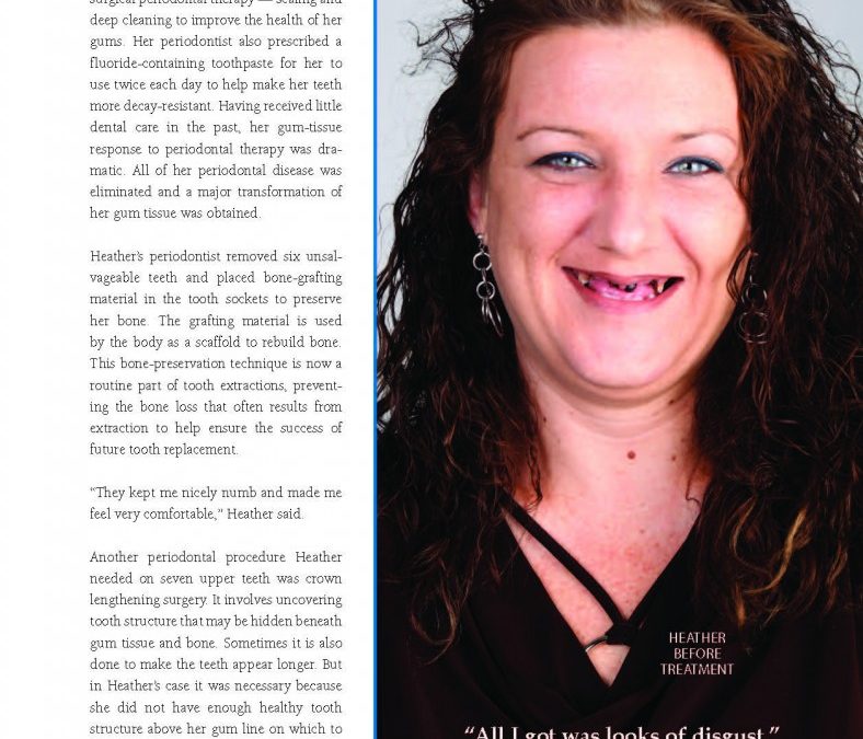 How A Smile Makeover Can Change Your Life
