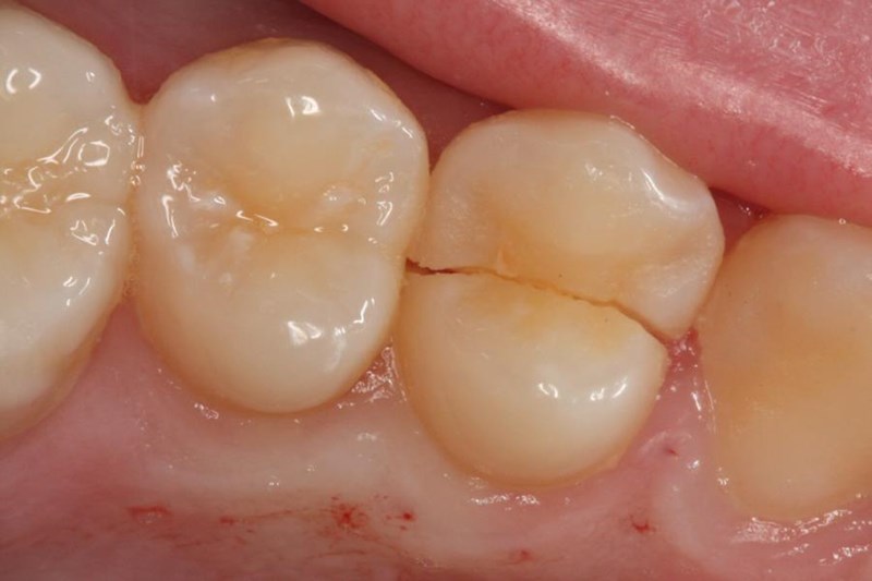familydentistomahanebraska